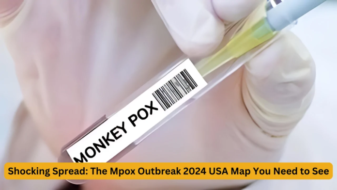 Mpox Outbreak 2024 USA Map