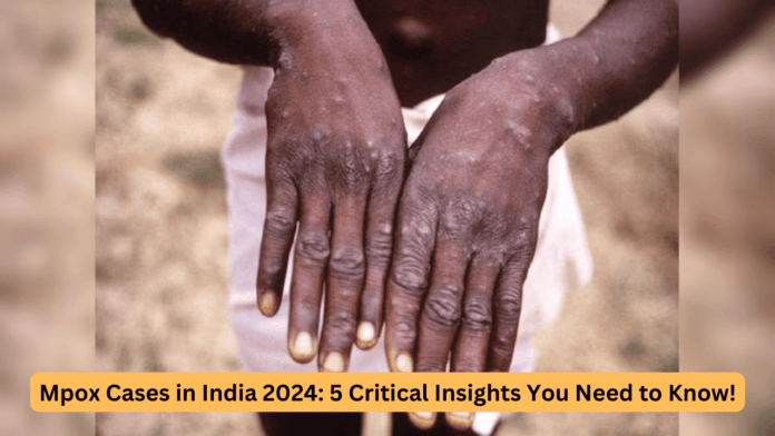 mpox cases in india 2024